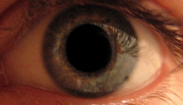 Dilatación pupila